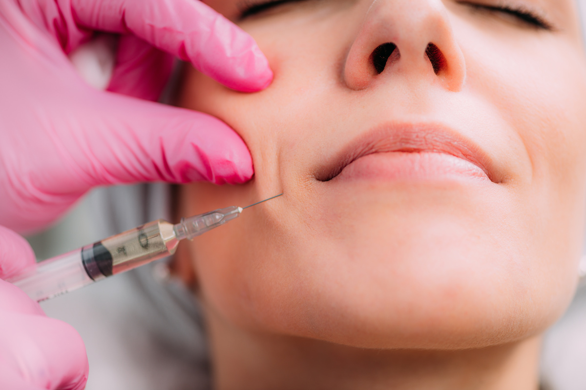 botox o filler