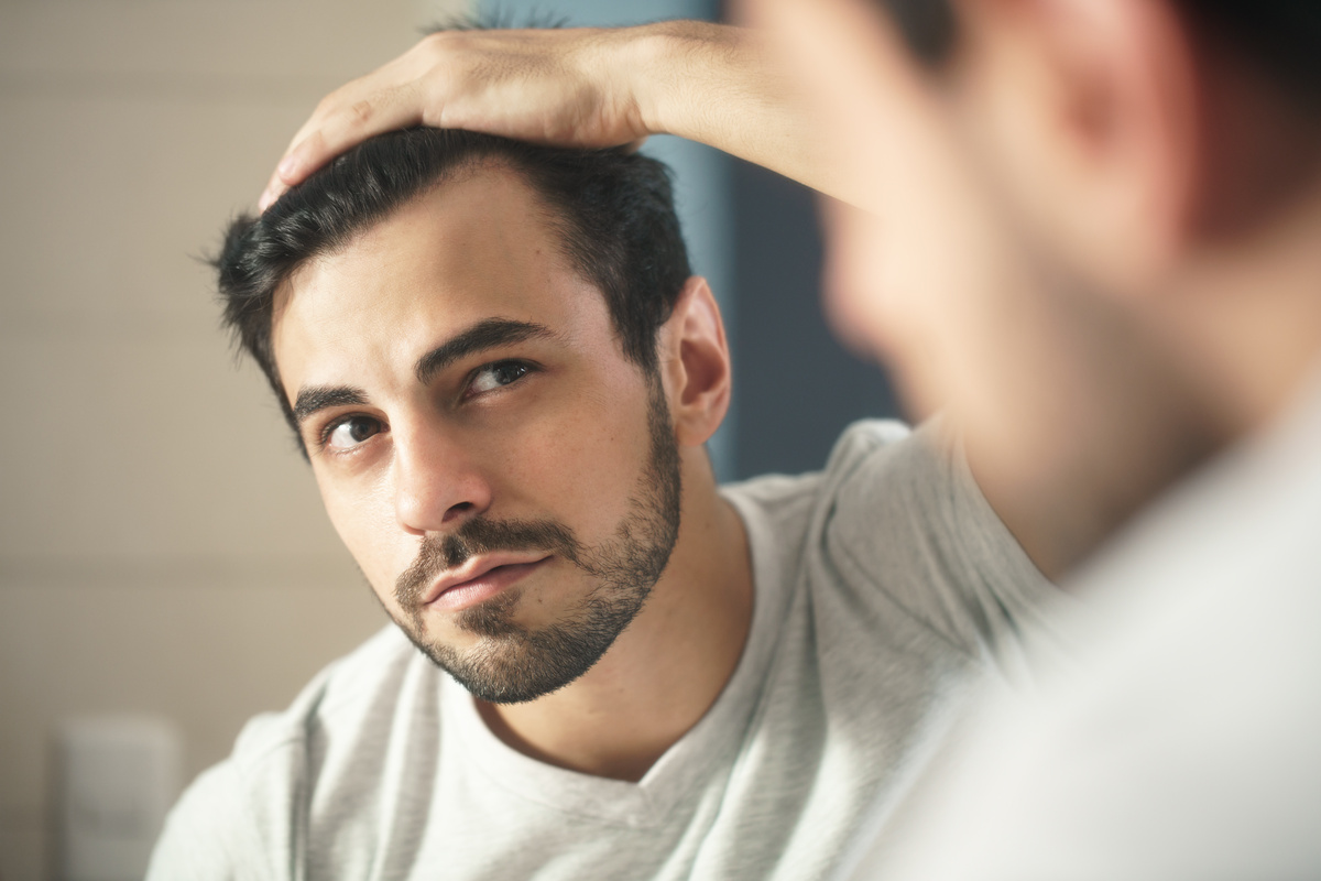 come curare l’alopecia androgenetica