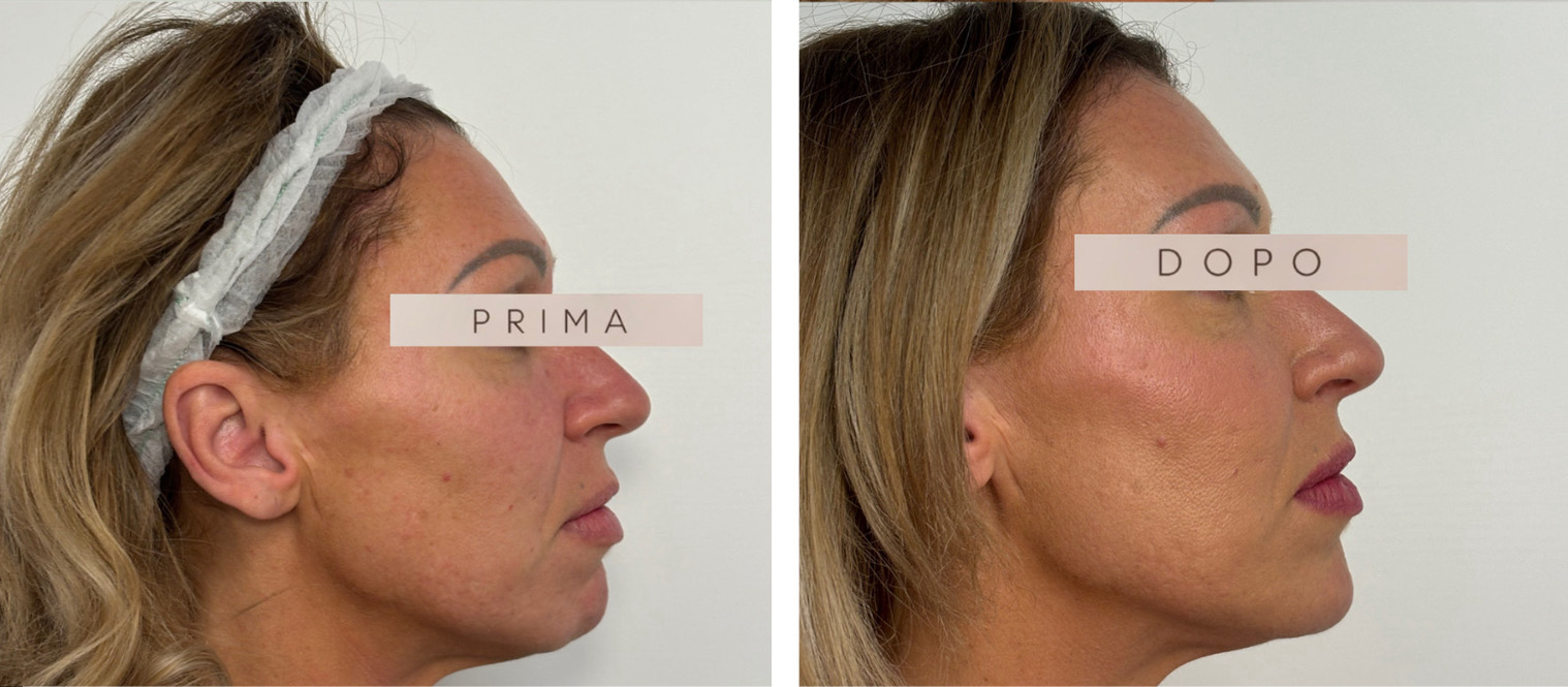 prima-dopo-04